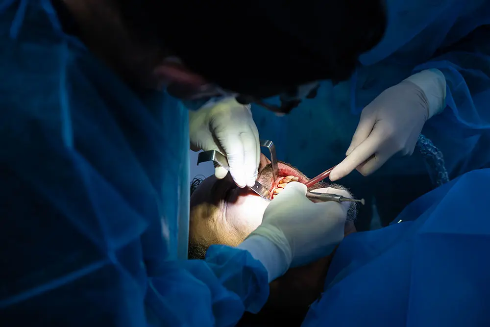 Un lambeau ouvert maintenu par les écarteurs pendant la chirurgie